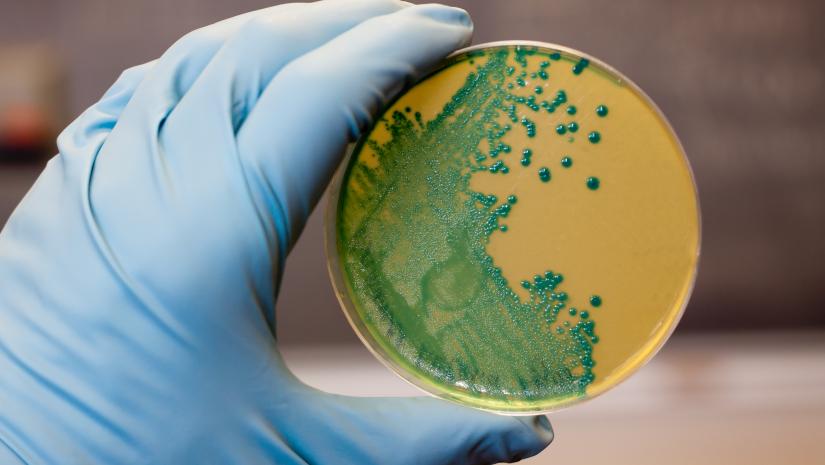 6 Types of Microorganisms That Cause Food-Borne Illness